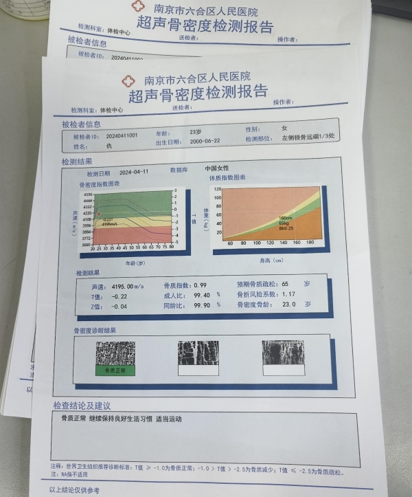 一文了解超聲骨密度儀的基本原理、技術(shù)特點及應(yīng)用領(lǐng)域